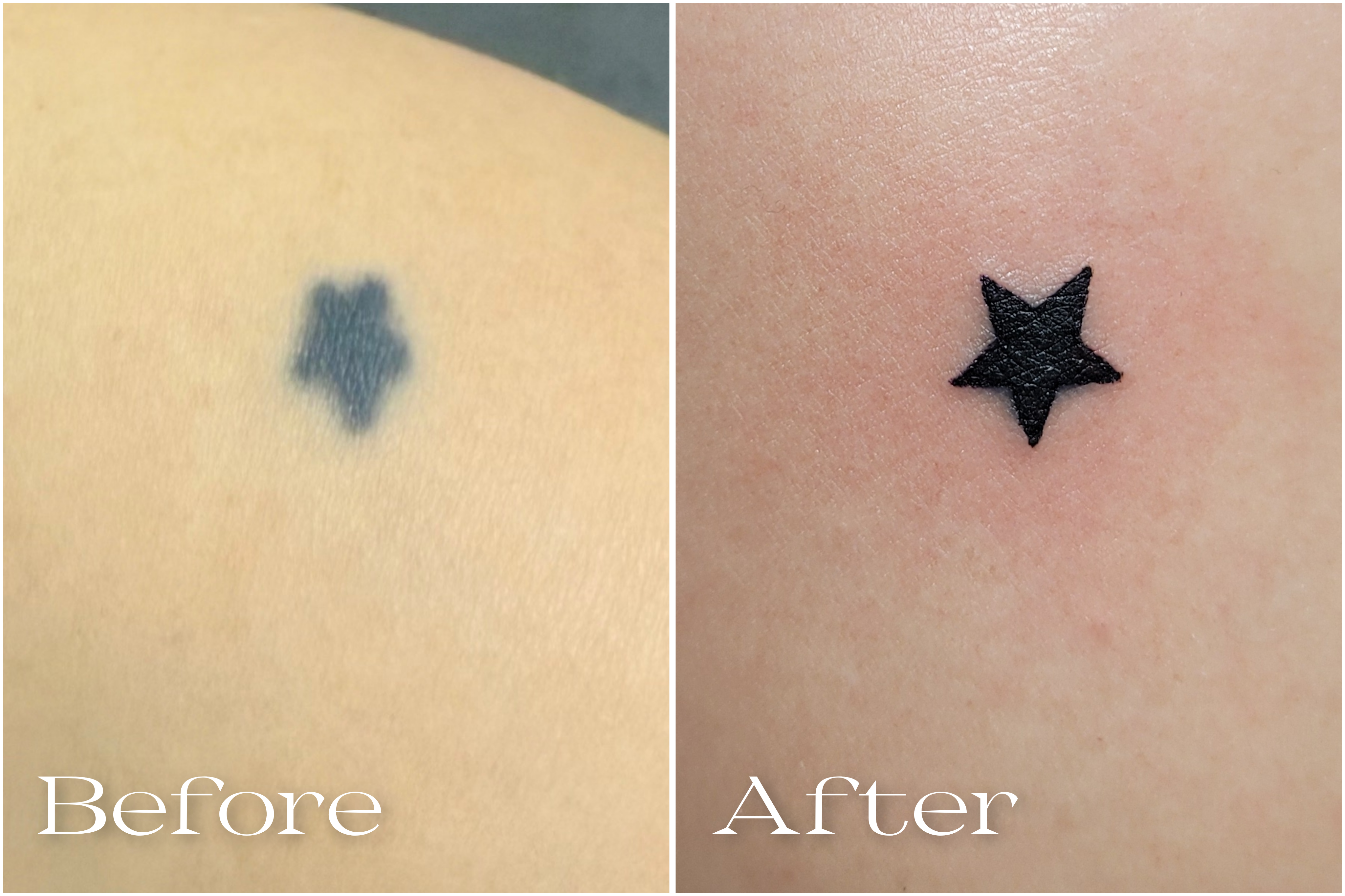 リメイクタトゥー_20250802